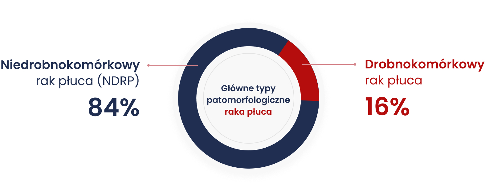 Rak płuca dzieli się na dwa główne typy patomorfologiczne: niedrobnokomórkowy (84%) i drobnokomórkowy (16%). Różnią się one przyjętą strategią i możliwościami leczenia oraz rokowaniem.
