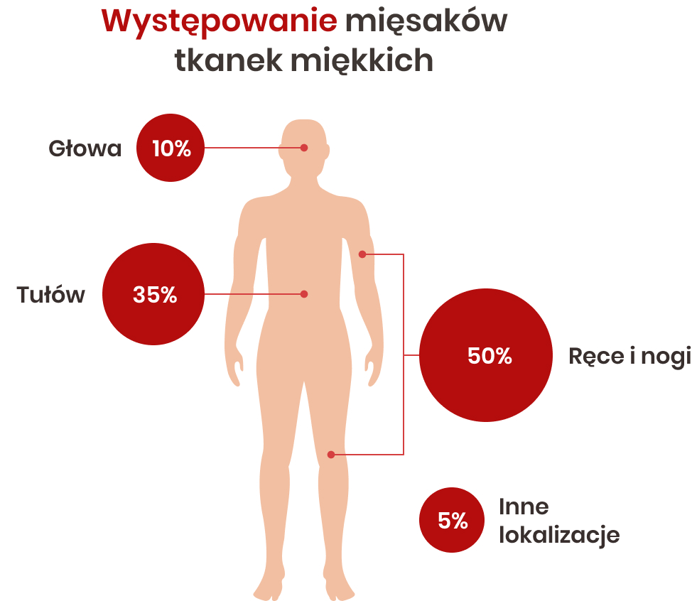 Występowanie mięsaków tkanek miękkich