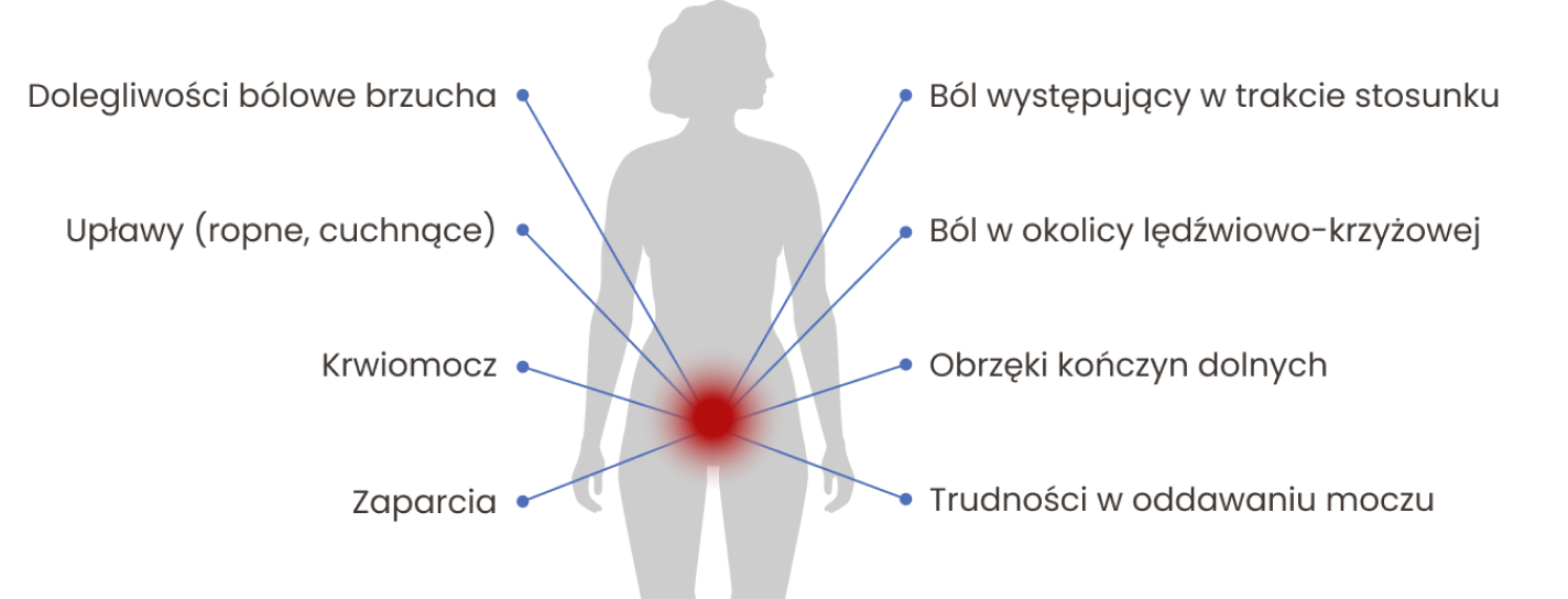 Podstawowe objawy raka szyjki macicy: ból brzucha, upławy, krwiomocz, zaparcia, ból podczas stosunku, obrzęk nóg, trudności w oddawaniu moczu