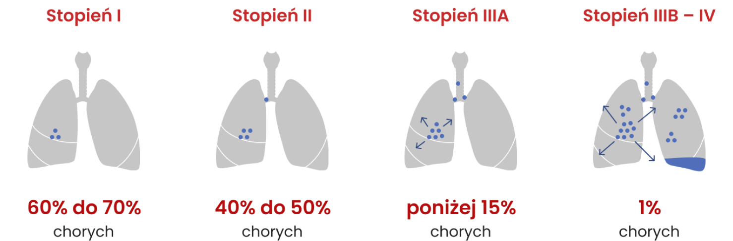 Odsetki 5-letnich przeżyć w zależności od zaawansowania raka płuca w momencie rozpoznania: stopień I – 60–70%, stopień II – 40–50%, stopień IIIA – poniżej 15%, IIIB–IV: 1%.