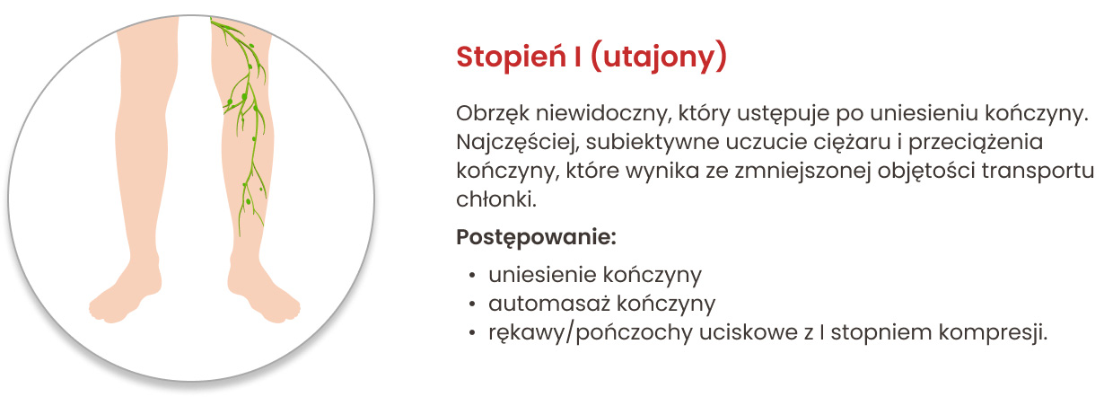 Stopnie obrzęku limfatycznego i zalecane postępowanie