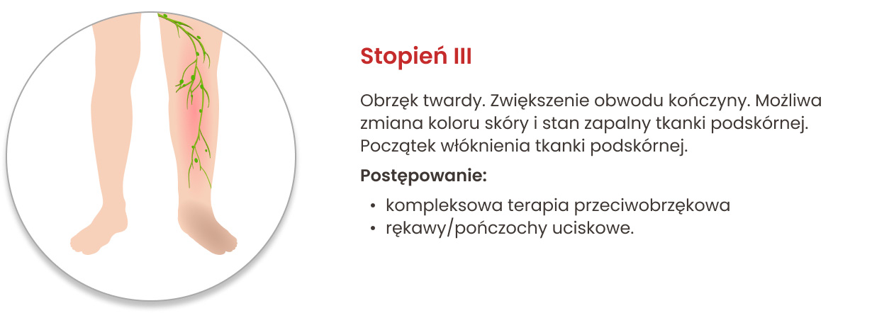 Stopnie obrzęku limfatycznego i zalecane postępowanie