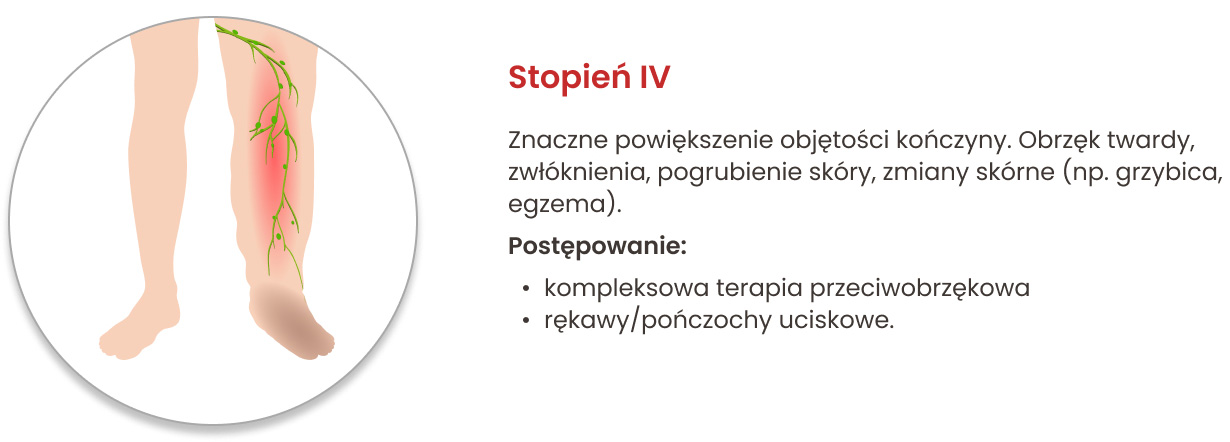 Stopnie obrzęku limfatycznego i zalecane postępowanie