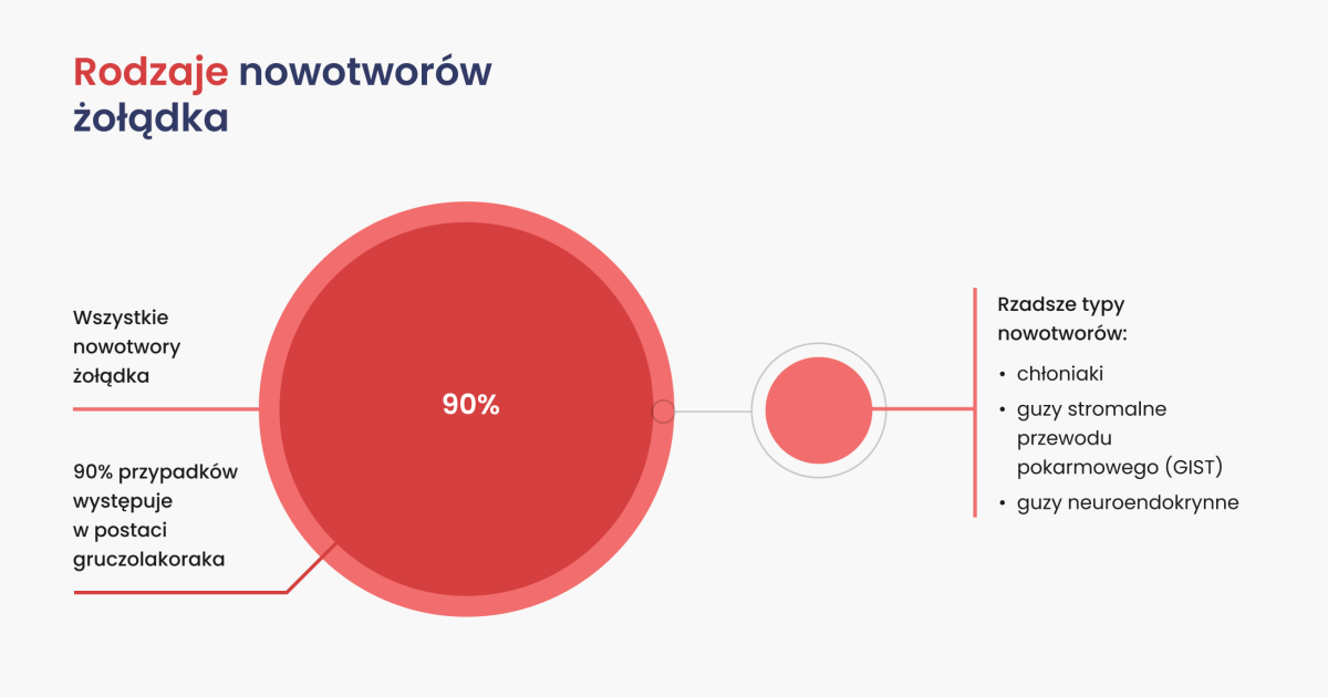 Schemat - rodzaje nowotworów żołądka