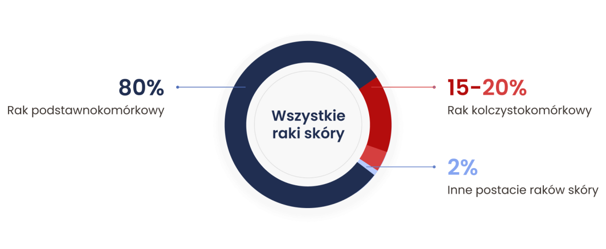 Rodzaje raków skóry