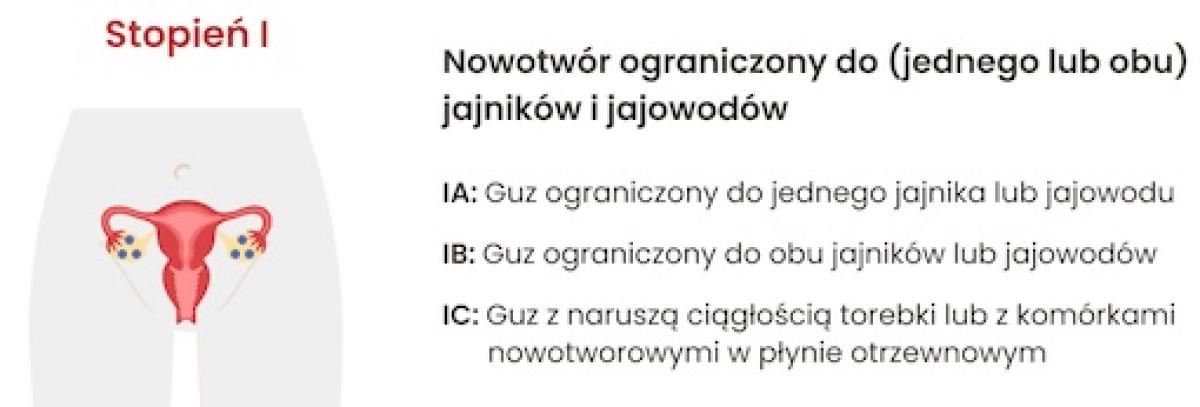 I stopień zaawansowania raka jajnika: Nowotwór ograniczony do (jednego lub obu) jajników i jajowodów