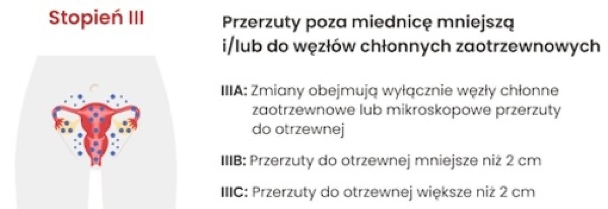 III stopień zaawansowania raka jajnika: Przerzuty poza miednicę mniejszą i/lub do węzłów chłonnych zaotrzewnowych